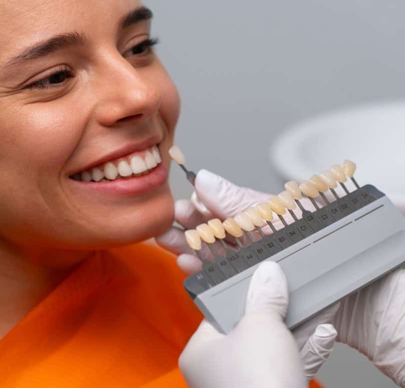Porcelain veneers